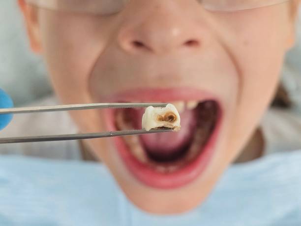 Best Pediatric Emergency Dentist in San Juan, TX